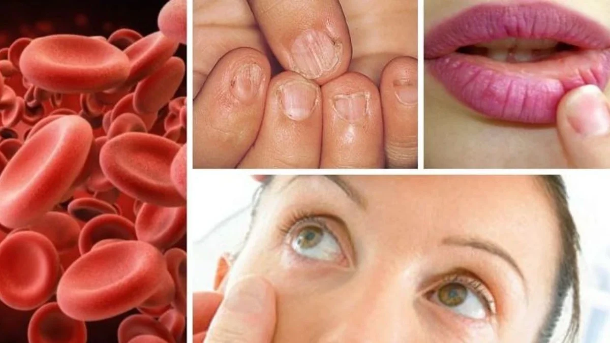 Demir Düşüklüğü Nedir? Kanda Demir Düşüklüğü Ne Anlama Gelir?