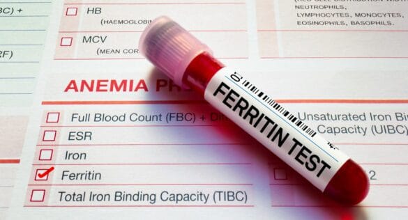 ferritin-testi