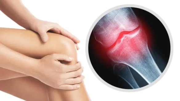 osteoartrit-nedir