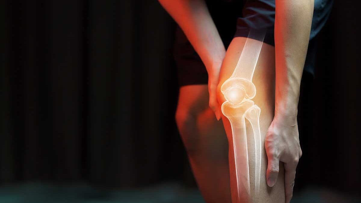 Eklem İçin Kolajen: Diz Ağrısı, Kıkırdak ve Osteoartrit