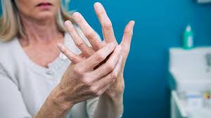 el-parmak-osteoartrit